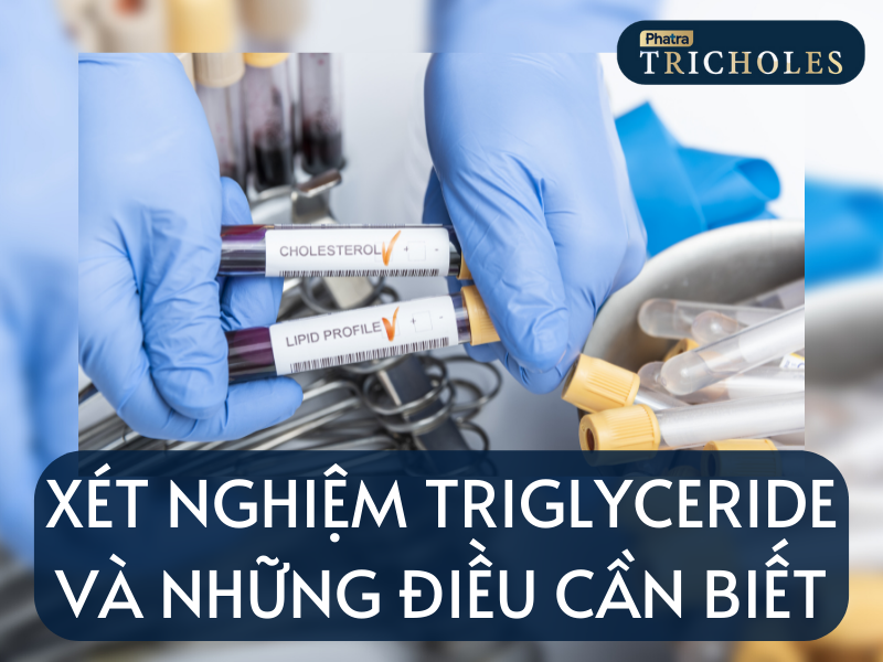 xét nghiệm triglyceride